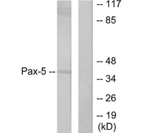 Western Blot - Anti-Pax-5 Antibody (C0297) - Antibodies.com