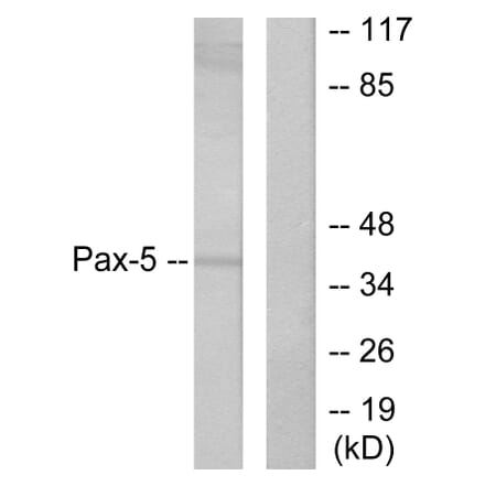 Western Blot - Anti-Pax-5 Antibody (C0297) - Antibodies.com