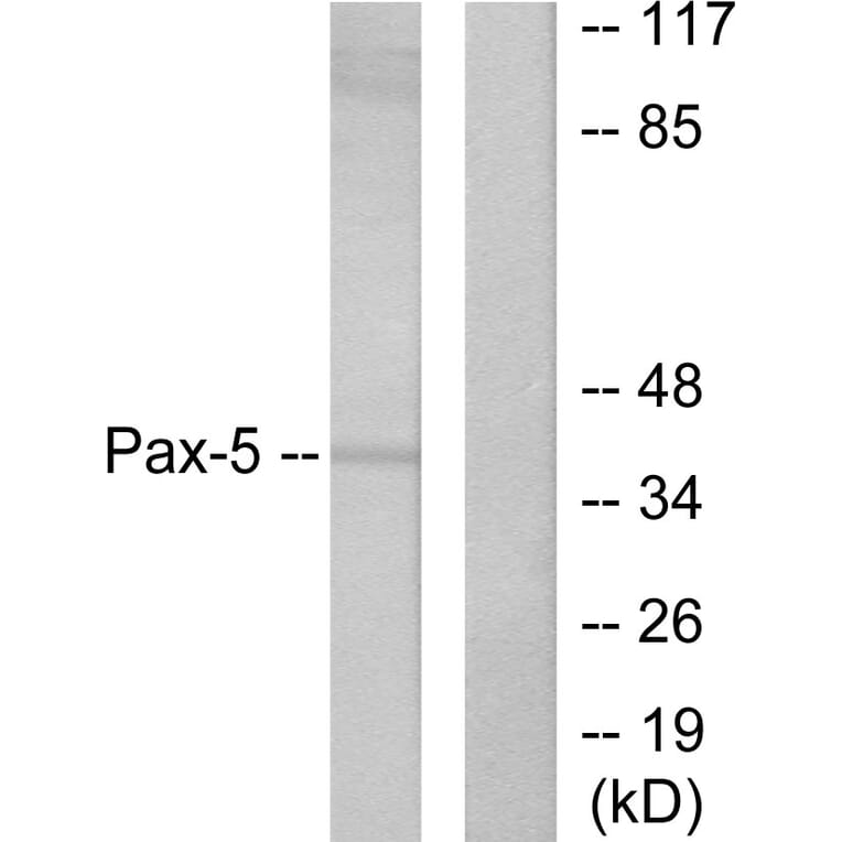 Western Blot - Anti-Pax-5 Antibody (C0297) - Antibodies.com