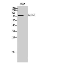 Western Blot - Anti-PARP2 Antibody (C13097) - Antibodies.com