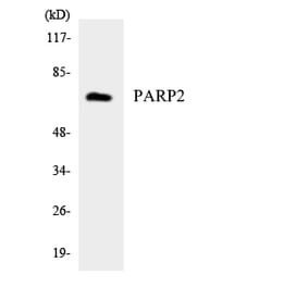 Western Blot - Anti-PARP2 Antibody (R12-3303) - Antibodies.com
