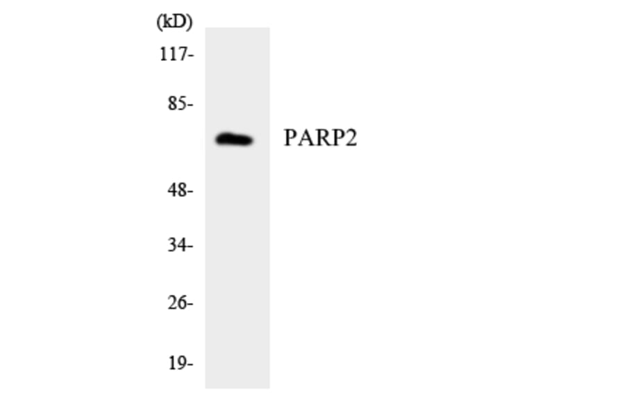 Western Blot - Anti-PARP2 Antibody (R12-3303) - Antibodies.com