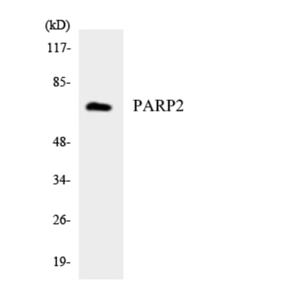 Western Blot - Anti-PARP2 Antibody (R12-3303) - Antibodies.com