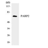 Western Blot - Anti-PARP2 Antibody (R12-3303) - Antibodies.com