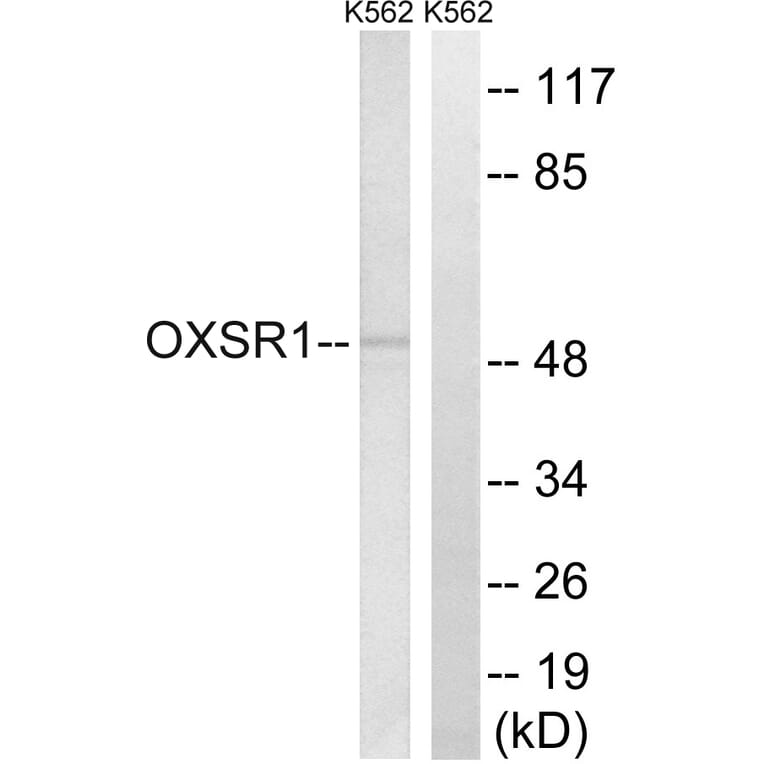 Western Blot - Anti-OXSR1 Antibody (C18587) - Antibodies.com