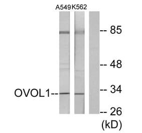 Western Blot - Anti-OVOL1 Antibody (C10046) - Antibodies.com
