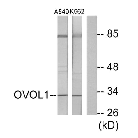 Western Blot - Anti-OVOL1 Antibody (C10046) - Antibodies.com