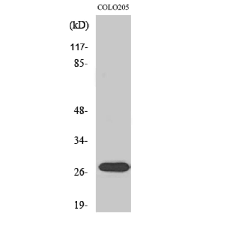 Western Blot - Anti-NRIP3 Antibody (C17129) - Antibodies.com