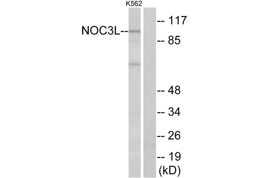 Western Blot - Anti-NOC3L Antibody (C17147) - Antibodies.com