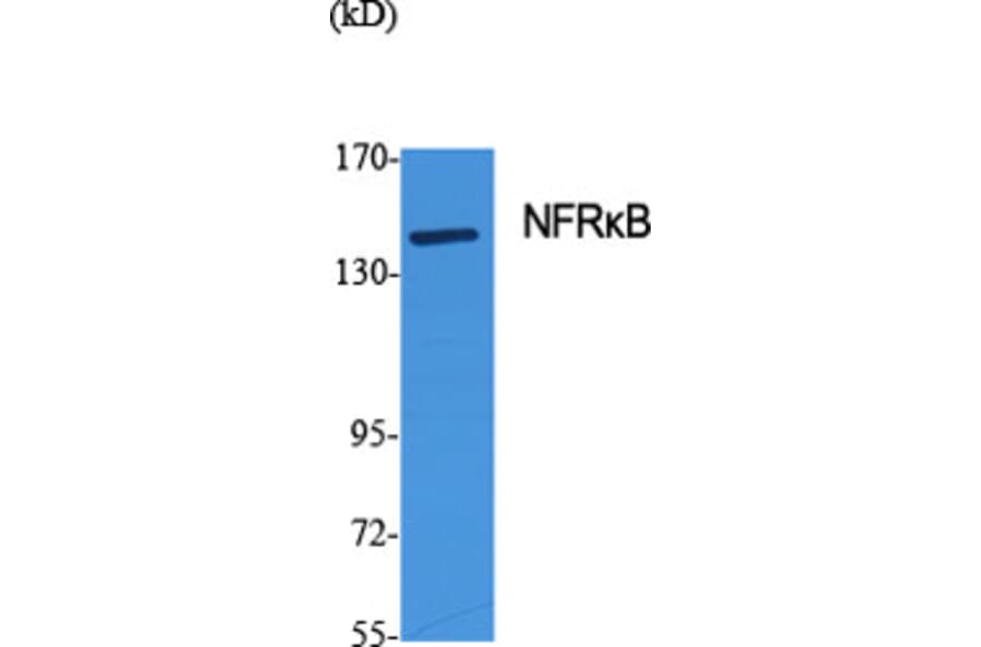 Western Blot - Anti-NFRKB Antibody (C17081) - Antibodies.com