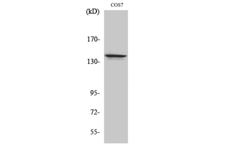 Western Blot - Anti-NFRKB Antibody (C17081) - Antibodies.com