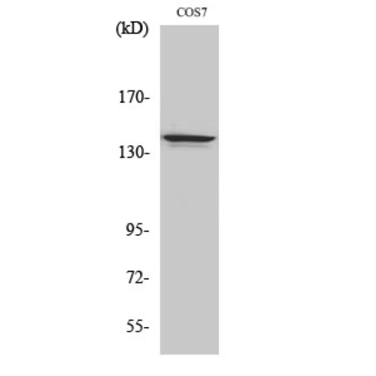 Western Blot - Anti-NFRKB Antibody (C17081) - Antibodies.com