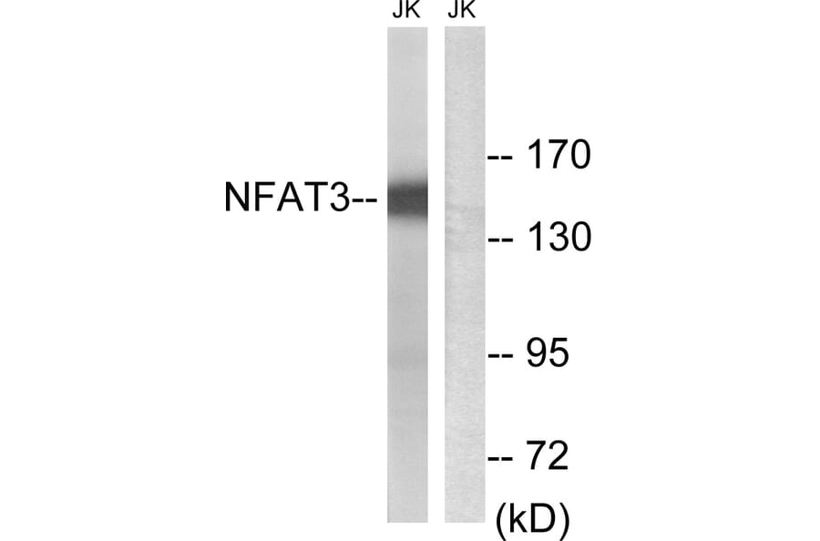 Western Blot - Anti-NFAT3 Antibody (B8385) - Antibodies.com
