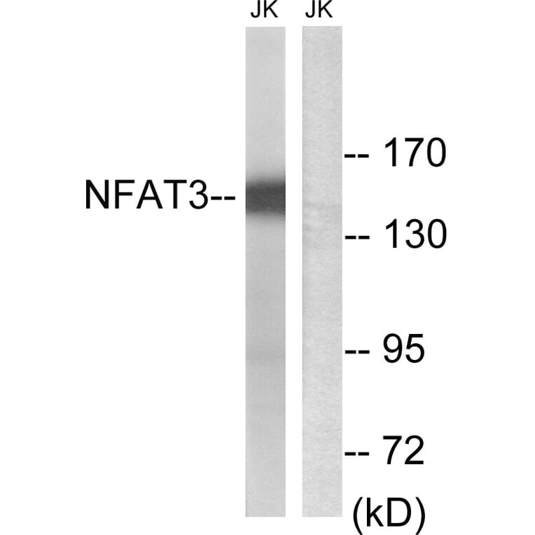 Western Blot - Anti-NFAT3 Antibody (B8385) - Antibodies.com