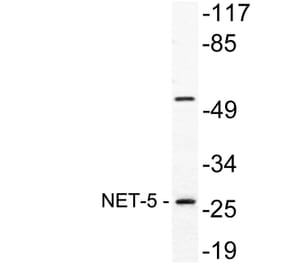 Western Blot - Anti-NET-5 Antibody (R12-2255) - Antibodies.com