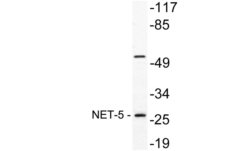 Western Blot - Anti-NET-5 Antibody (R12-2255) - Antibodies.com