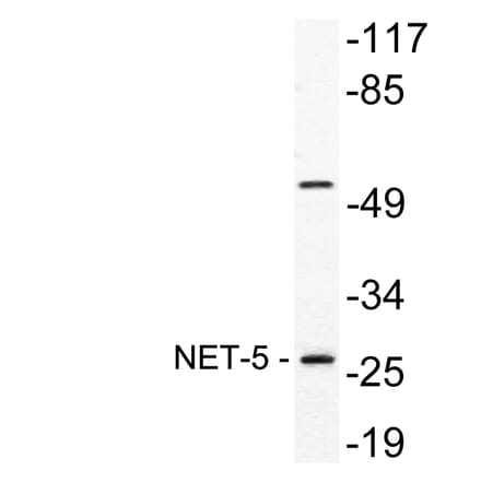 Western Blot - Anti-NET-5 Antibody (R12-2255) - Antibodies.com