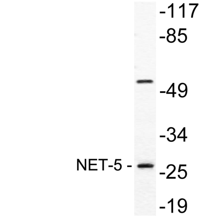 Western Blot - Anti-NET-5 Antibody (R12-2255) - Antibodies.com
