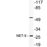 Western Blot - Anti-NET-5 Antibody (R12-2255) - Antibodies.com