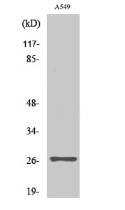 Anti-NET-5 Antibody (A99023) | Antibodies.com