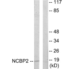 Western Blot - Anti-NCBP2 Antibody (C10694) - Antibodies.com