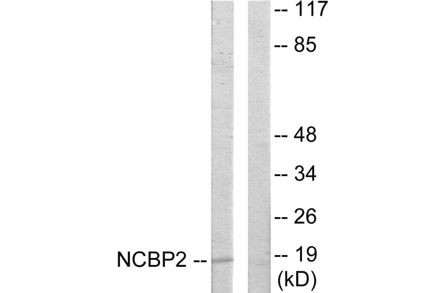Western Blot - Anti-NCBP2 Antibody (C10694) - Antibodies.com