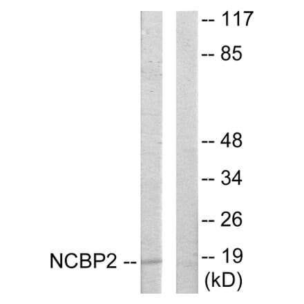 Western Blot - Anti-NCBP2 Antibody (C10694) - Antibodies.com