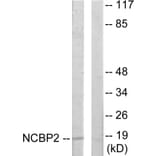 Western Blot - Anti-NCBP2 Antibody (C10694) - Antibodies.com