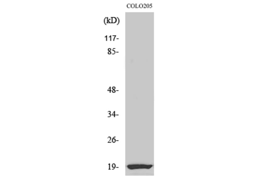 Western Blot - Anti-NCBP2 Antibody (C10694) - Antibodies.com