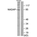 Western Blot - Anti-NADAP Antibody (C11628) - Antibodies.com