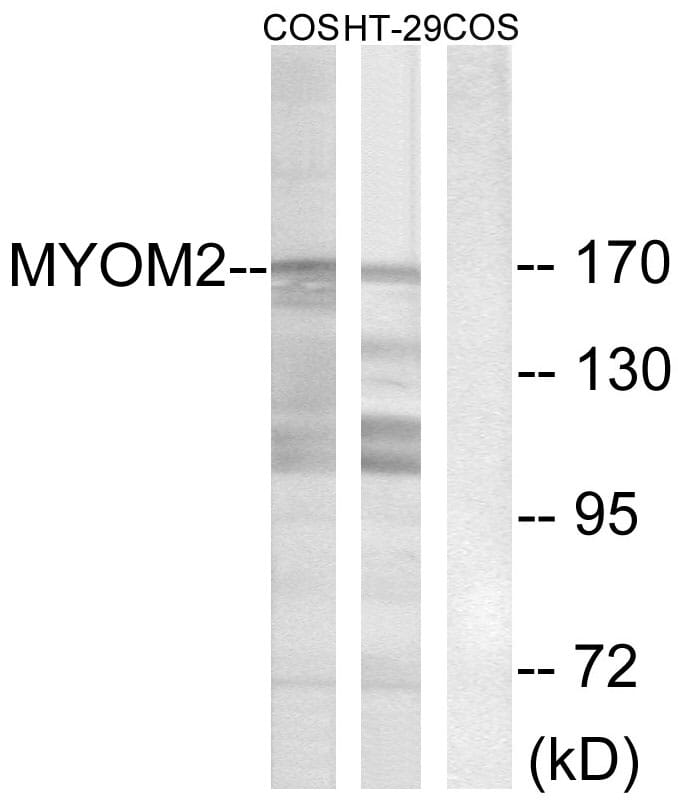 Western blot analysis of lysates from COS7 and HT-29 cells using Anti-MYOM2 Antibody. The right hand lane represents a negative control, where the antibody is blocked by the immunising peptide.