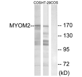 Western Blot - Anti-MYOM2 Antibody (C16760) - Antibodies.com