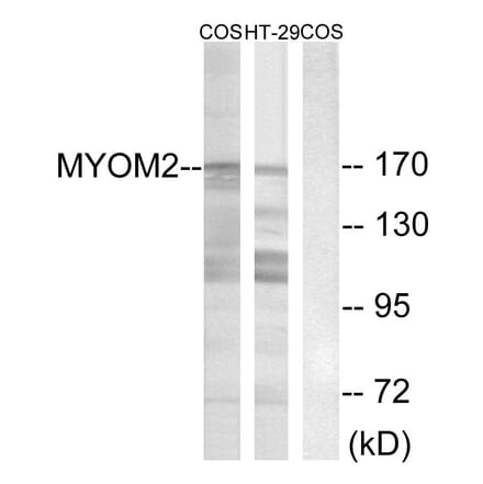 Western Blot - Anti-MYOM2 Antibody (C16760) - Antibodies.com