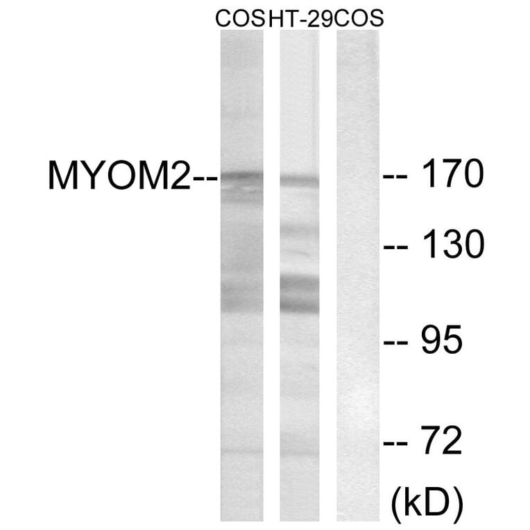 Western Blot - Anti-MYOM2 Antibody (C16760) - Antibodies.com