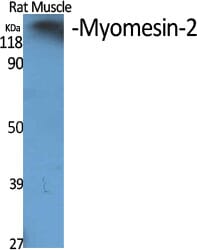 Western blot analysis of various cells using Anti-MYOM2 Antibody.