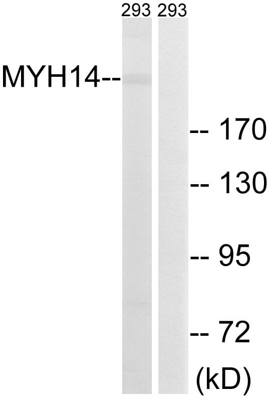 Western blot analysis of lysates from 293 cells using Anti-MYH14 Antibody. The right hand lane represents a negative control, where the antibody is blocked by the immunising peptide.