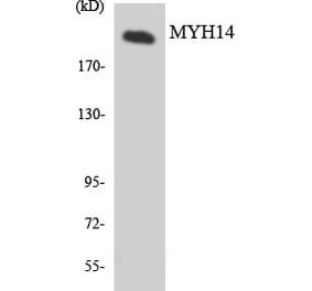 Western Blot - Anti-MYH14 Antibody (R12-3066) - Antibodies.com