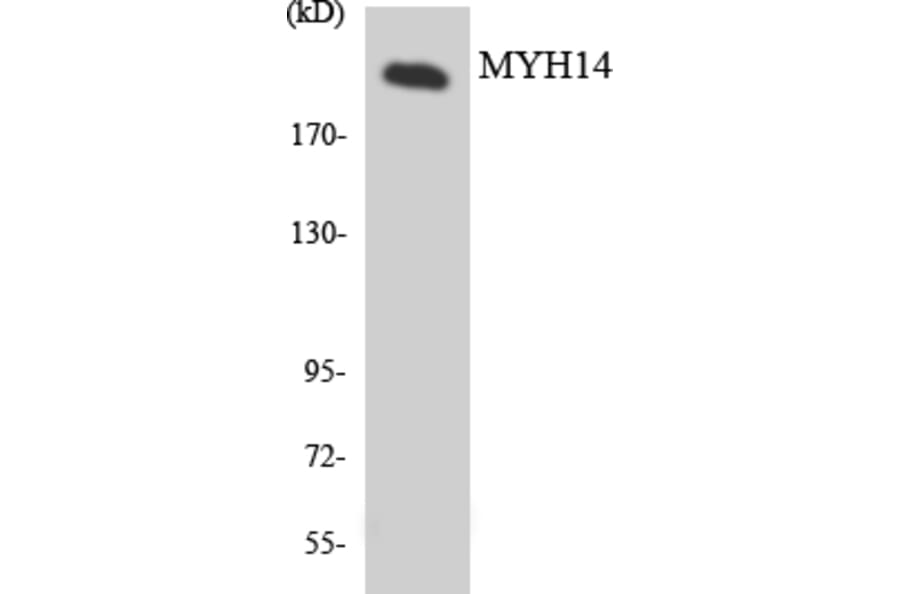 Western Blot - Anti-MYH14 Antibody (R12-3066) - Antibodies.com