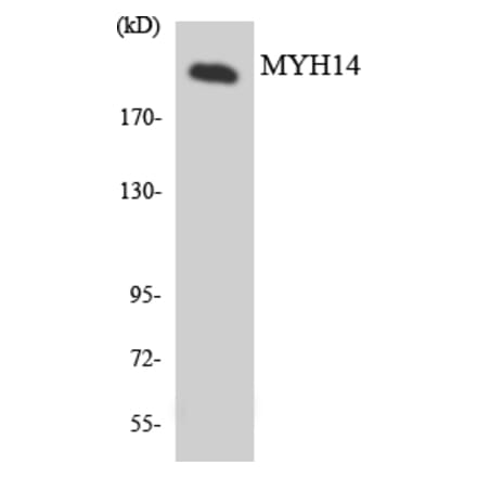 Western Blot - Anti-MYH14 Antibody (R12-3066) - Antibodies.com