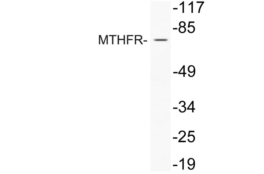 Western Blot - Anti-MTHFR Antibody (R12-2243) - Antibodies.com
