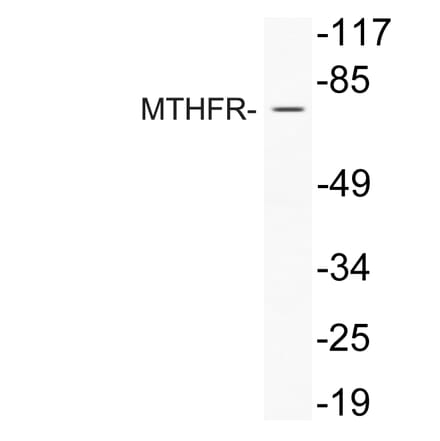 Western Blot - Anti-MTHFR Antibody (R12-2243) - Antibodies.com