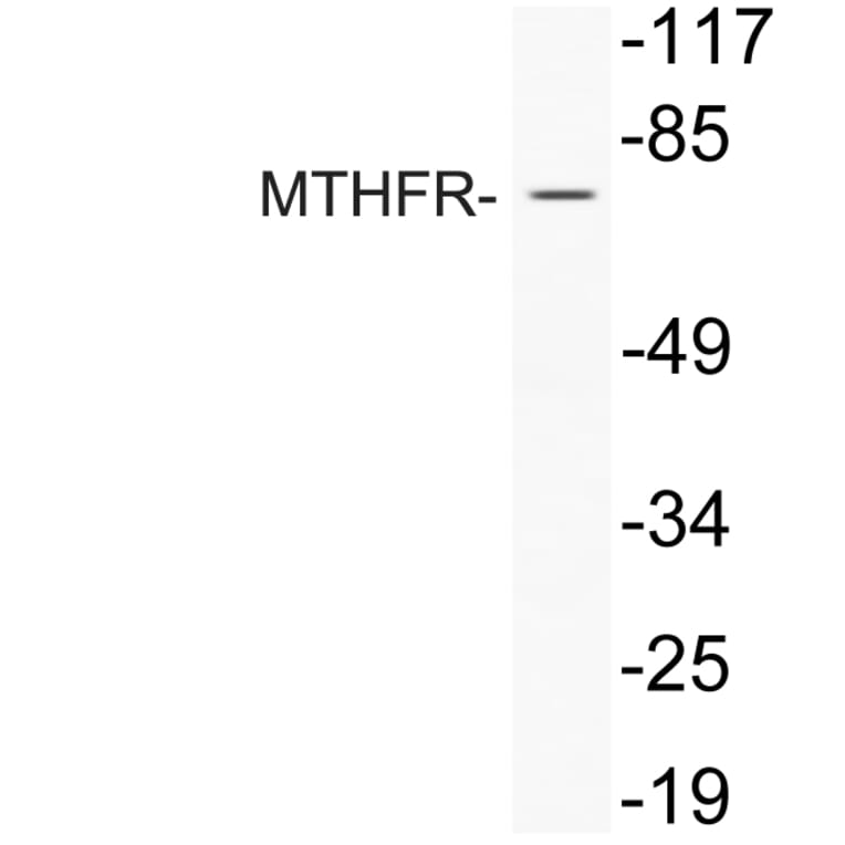 Western Blot - Anti-MTHFR Antibody (R12-2243) - Antibodies.com
