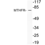 Western Blot - Anti-MTHFR Antibody (R12-2243) - Antibodies.com
