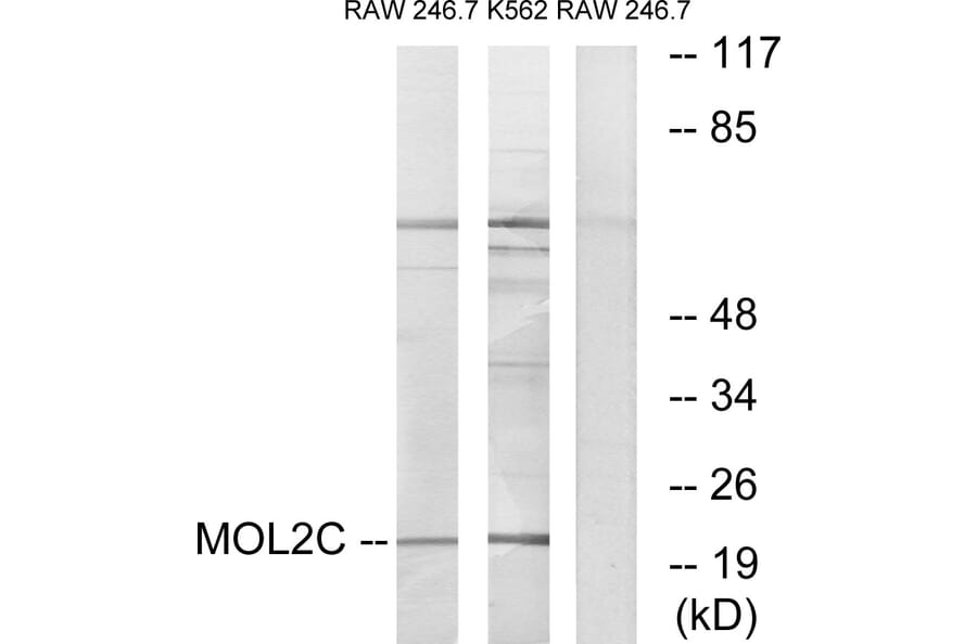 Western Blot - Anti-MOL2C Antibody (C11242) - Antibodies.com
