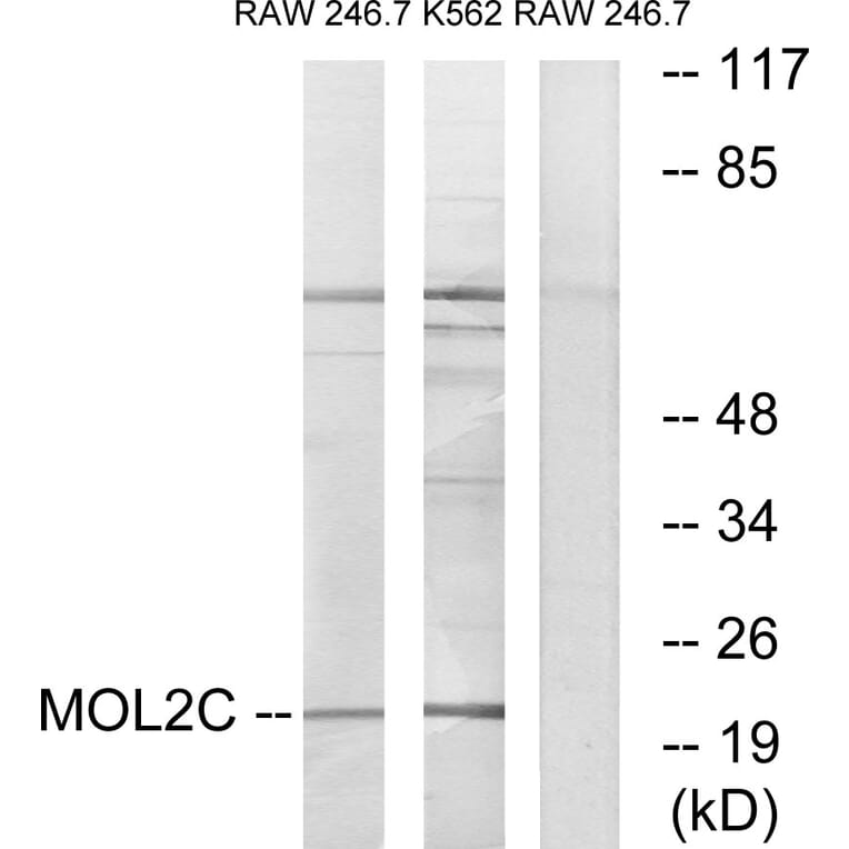 Western Blot - Anti-MOL2C Antibody (C11242) - Antibodies.com