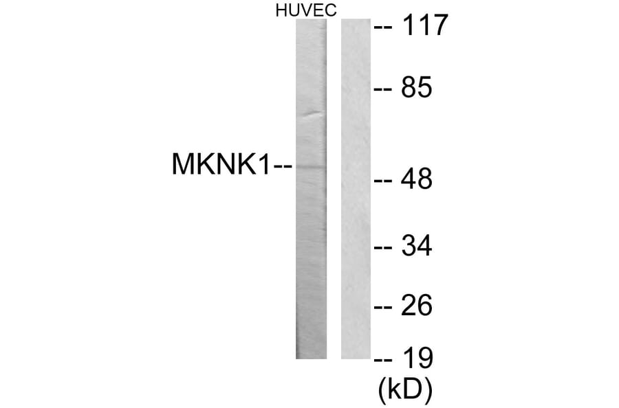 Western Blot - Anti-MKNK1 Antibody (C11615) - Antibodies.com