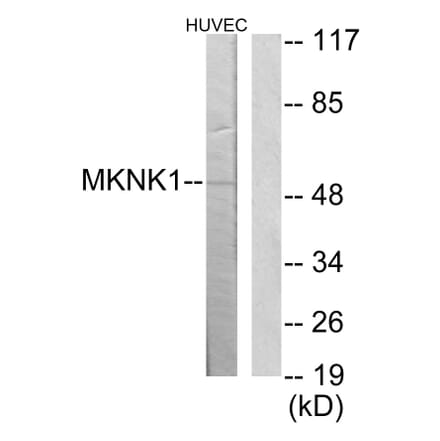 Western Blot - Anti-MKNK1 Antibody (C11615) - Antibodies.com
