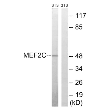 Western Blot - Anti-MEF2C Antibody (B8370) - Antibodies.com