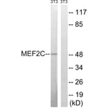 Western Blot - Anti-MEF2C Antibody (B8370) - Antibodies.com