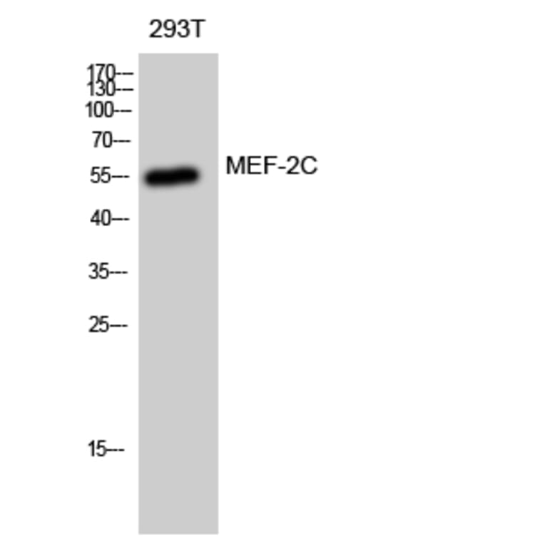 Western Blot - Anti-MEF2C Antibody (B8370) - Antibodies.com